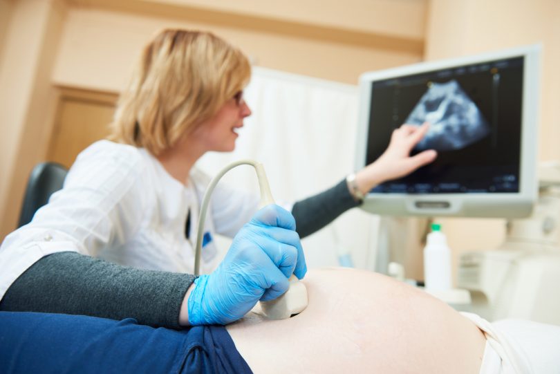 Gynecologist checking fetal life with scanner.